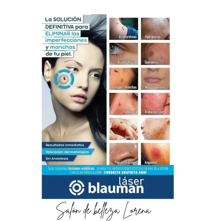 tratamientos-faciales-salon-de-belleza-lorena